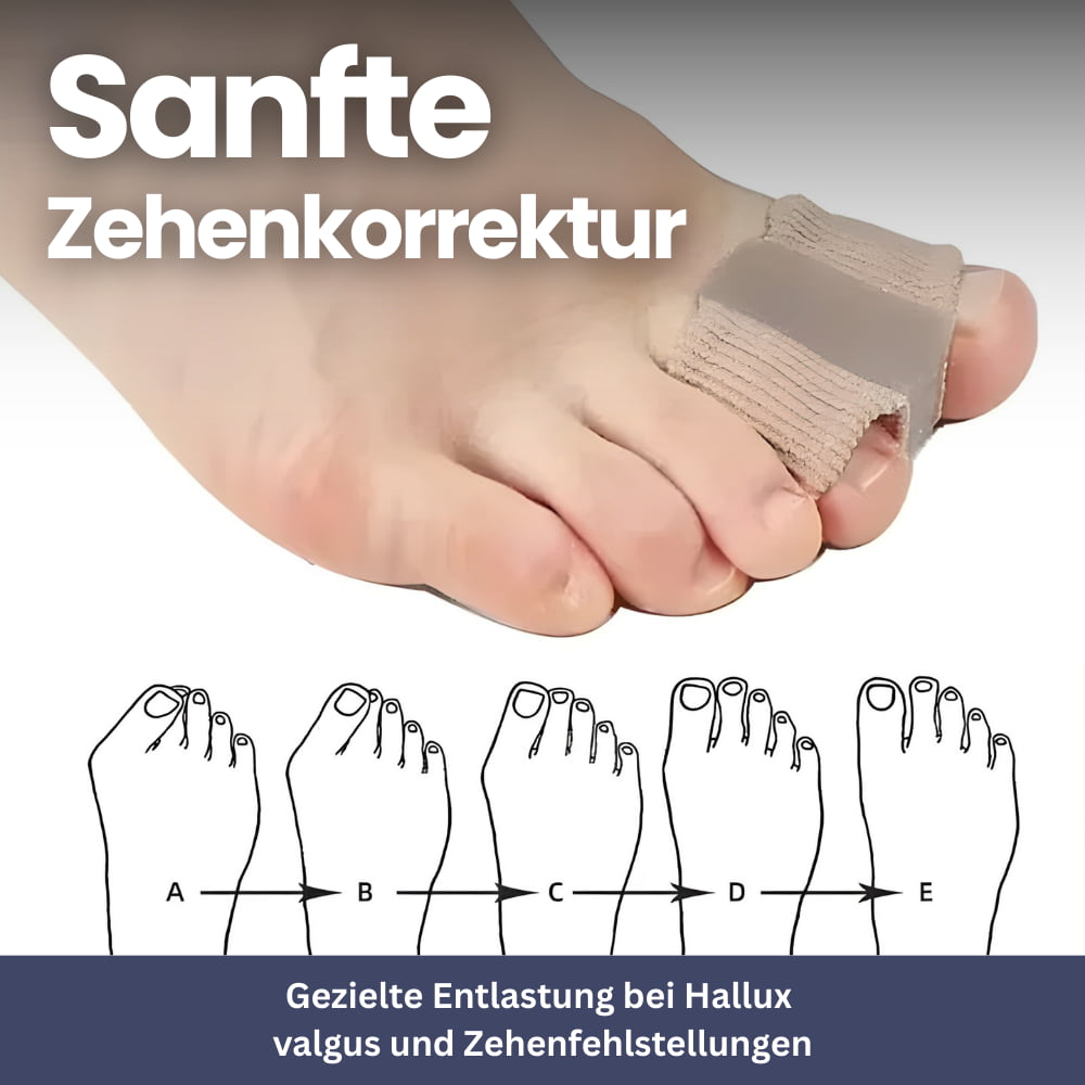 SoftAlign – Toe Protector & Bunion Corrector