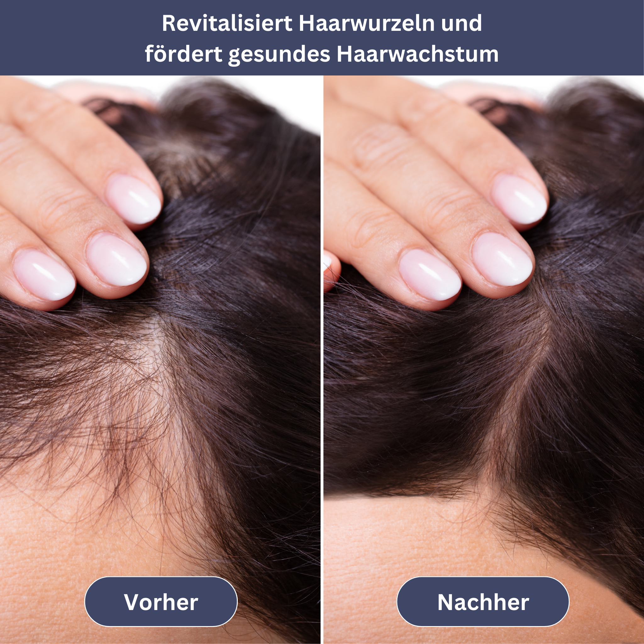 HairVital Light Therapy Cap
