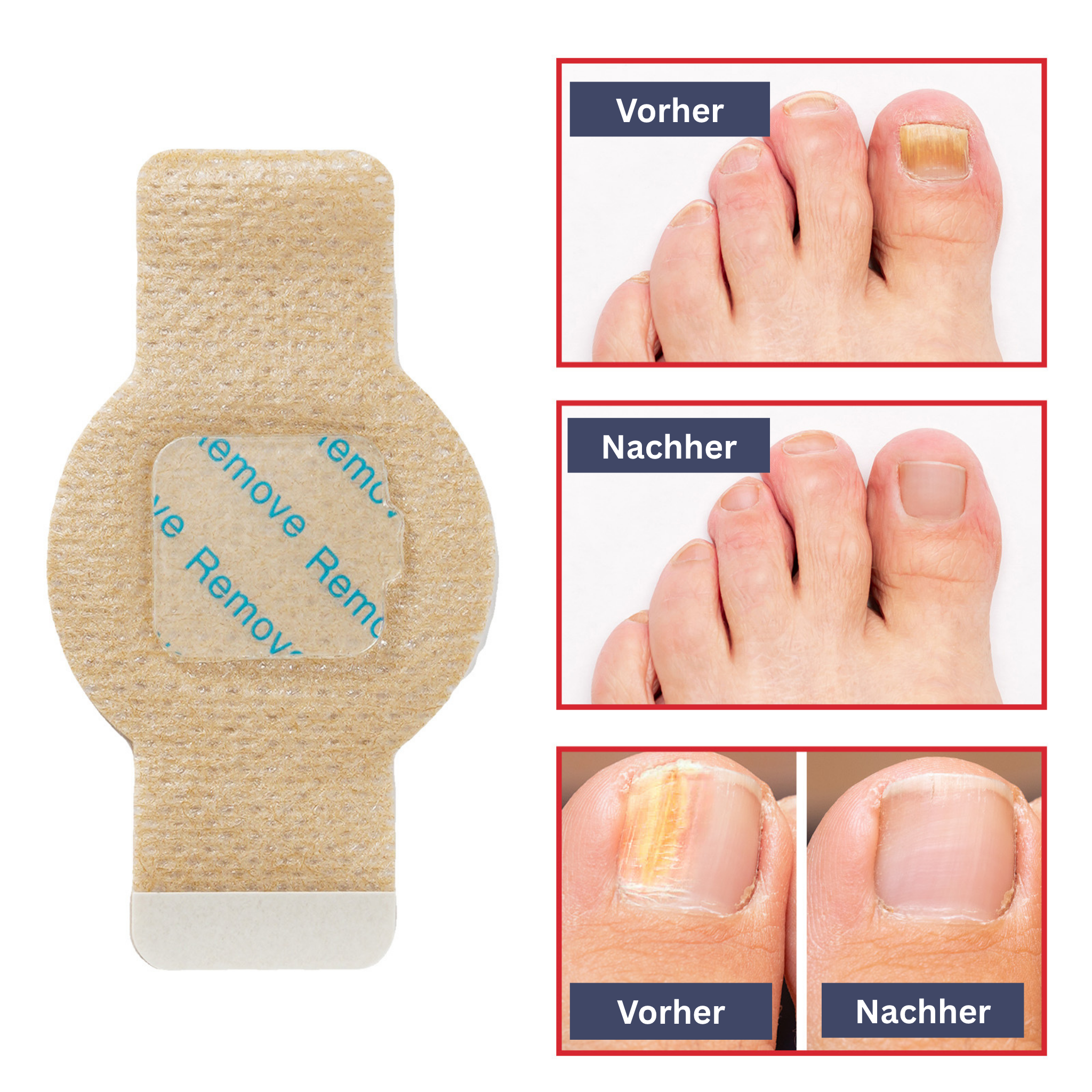 Nail care hydrogel patches