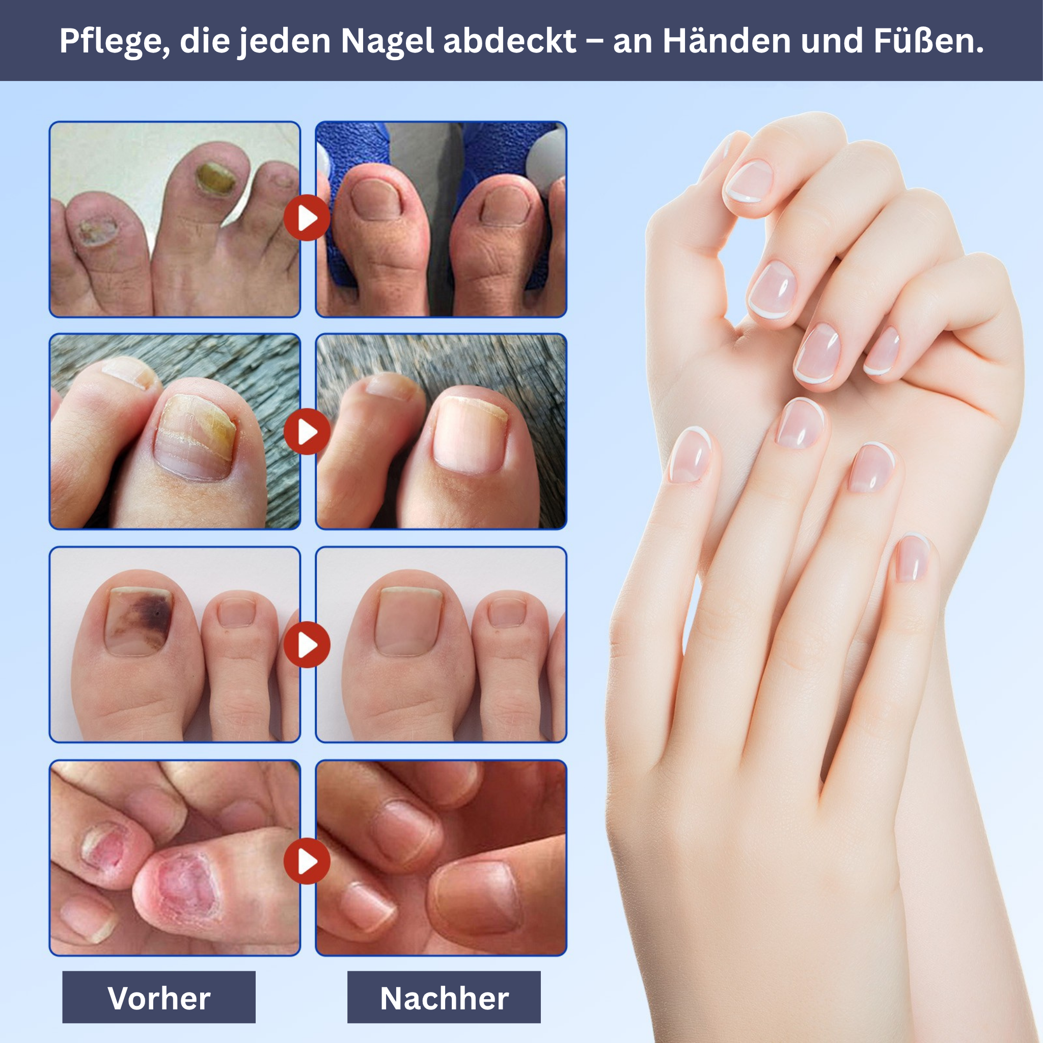 Nail care hydrogel patches
