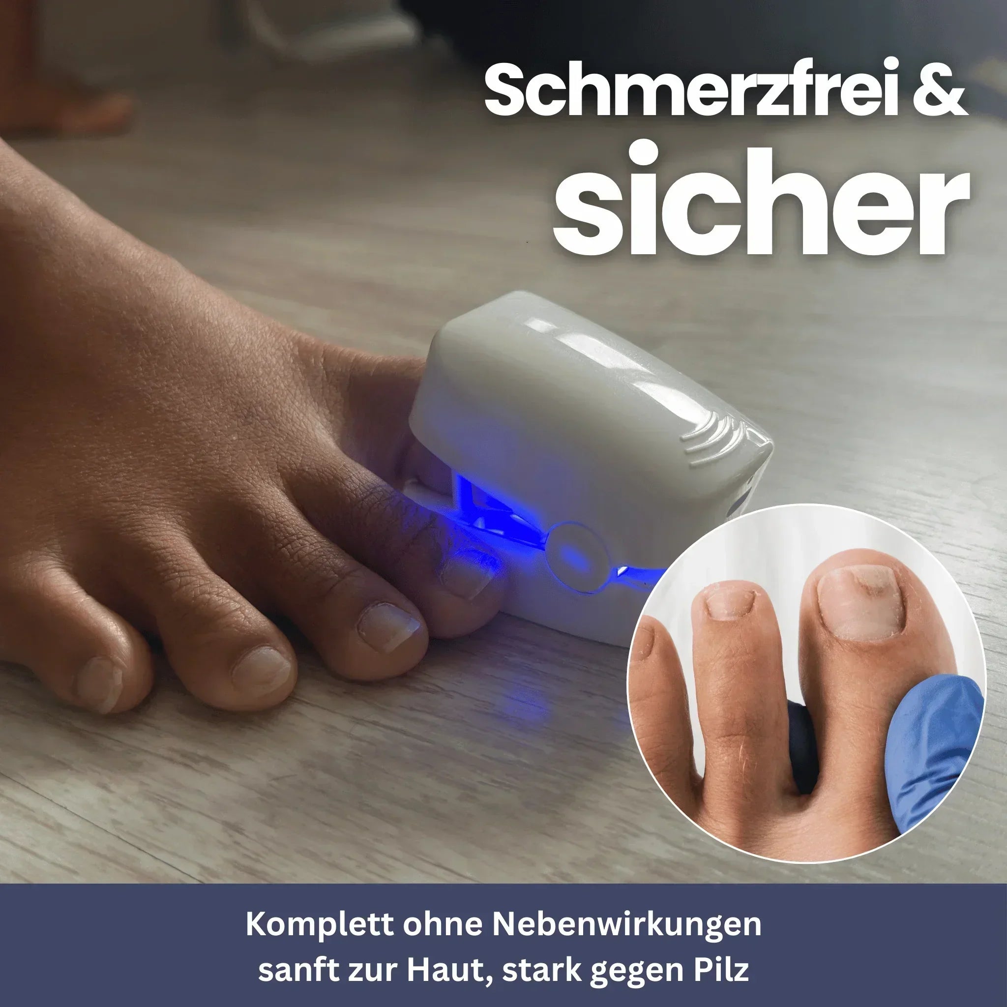 NailClip – Nail Fungus Therapy Device